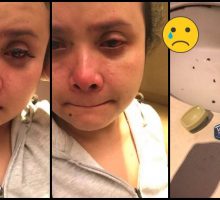 Gadis di Malaysia Sesali Pakai Ekstensi Bulu Mata, Niat Dilepas tapi Bulu Mata Alaminya Malah Rontok