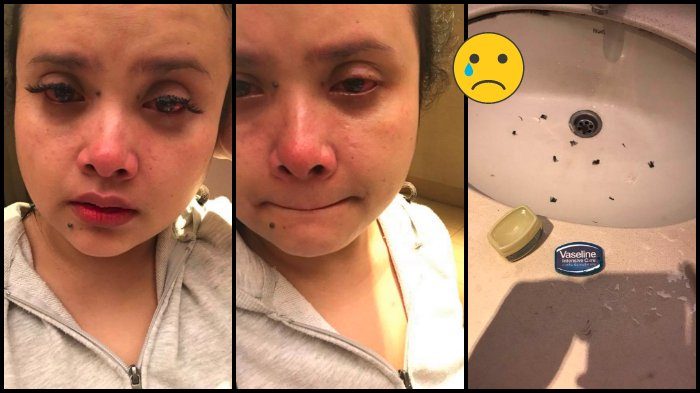 Gadis di Malaysia Sesali Pakai Ekstensi Bulu Mata, Niat Dilepas tapi Bulu Mata Alaminya Malah Rontok