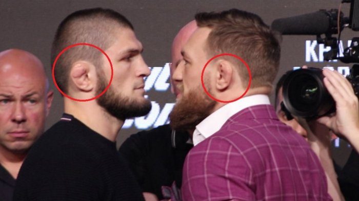 Penyebab Para Petarung UFC Memiliki Bentuk Daun Telinga yang Tak Biasa Penyebab Para Petarung UFC Memiliki Bentuk Daun Telinga yang Tak Biasa
